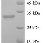 SDS-PAGE separation of QP8907 followed by commassie total protein stain results in a primary band consistent with reported data for Histone deacetylase 7. These data demonstrate Greater than 90% as determined by SDS-PAGE.