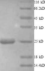 SDS-PAGE separation of QP8908 followed by commassie total protein stain results in a primary band consistent with reported data for Histone deacetylase 7. These data demonstrate Greater than 90% as determined by SDS-PAGE.