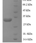 SDS-PAGE separation of QP8912 followed by commassie total protein stain results in a primary band consistent with reported data for Zinc transporter ZIP1. These data demonstrate Greater than 90% as determined by SDS-PAGE.