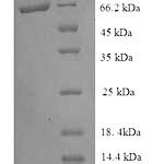 SDS-PAGE separation of QP8913 followed by commassie total protein stain results in a primary band consistent with reported data for Pyruvate dehydrogenase [ubiquinone]. These data demonstrate Greater than 90% as determined by SDS-PAGE.