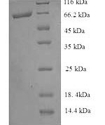 SDS-PAGE separation of QP8913 followed by commassie total protein stain results in a primary band consistent with reported data for Pyruvate dehydrogenase [ubiquinone]. These data demonstrate Greater than 90% as determined by SDS-PAGE.