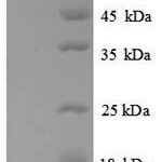 SDS-PAGE separation of QP8915 followed by commassie total protein stain results in a primary band consistent with reported data for ATP-dependent DNA helicase RecQ. These data demonstrate Greater than 90% as determined by SDS-PAGE.