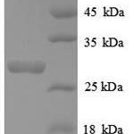 SDS-PAGE separation of QP8919 followed by commassie total protein stain results in a primary band consistent with reported data for Telomerase protein component 1. These data demonstrate Greater than 90% as determined by SDS-PAGE.