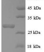 SDS-PAGE separation of QP8919 followed by commassie total protein stain results in a primary band consistent with reported data for Telomerase protein component 1. These data demonstrate Greater than 90% as determined by SDS-PAGE.