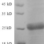 SDS-PAGE separation of QP8922 followed by commassie total protein stain results in a primary band consistent with reported data for Neutral trehalase. These data demonstrate Greater than 90% as determined by SDS-PAGE.