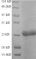 SDS-PAGE separation of QP8922 followed by commassie total protein stain results in a primary band consistent with reported data for Neutral trehalase. These data demonstrate Greater than 90% as determined by SDS-PAGE.