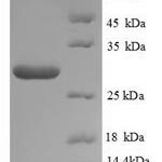 SDS-PAGE separation of QP8923 followed by commassie total protein stain results in a primary band consistent with reported data for Neutral trehalase. These data demonstrate Greater than 90% as determined by SDS-PAGE.