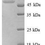 SDS-PAGE separation of QP8930 followed by commassie total protein stain results in a primary band consistent with reported data for Tubulin beta-1 chain. These data demonstrate Greater than 90% as determined by SDS-PAGE.