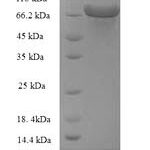 SDS-PAGE separation of QP8937 followed by commassie total protein stain results in a primary band consistent with reported data for Glucose-6-phosphate 1-dehydrogenase. These data demonstrate Greater than 90% as determined by SDS-PAGE.