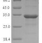 SDS-PAGE separation of QP8949 followed by commassie total protein stain results in a primary band consistent with reported data for C-C motif chemokine. These data demonstrate Greater than 90% as determined by SDS-PAGE.