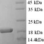 SDS-PAGE separation of QP8951 followed by commassie total protein stain results in a primary band consistent with reported data for A2M / CPAMD5 / Alpha-2-macroglobulin. These data demonstrate Greater than 90% as determined by SDS-PAGE.