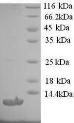SDS-PAGE separation of QP8960 followed by commassie total protein stain results in a primary band consistent with reported data for Type-1 angiotensin II receptor. These data demonstrate Greater than 90% as determined by SDS-PAGE.
