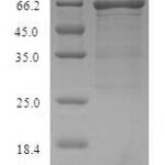 SDS-PAGE separation of QP8965 followed by commassie total protein stain results in a primary band consistent with reported data for Serum Albumin / HSA / ALB. These data demonstrate Greater than 90% as determined by SDS-PAGE.