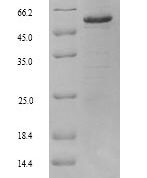 SDS-PAGE separation of QP8968 followed by commassie total protein stain results in a primary band consistent with reported data for Retinal dehydrogenase 2. These data demonstrate Greater than 90% as determined by SDS-PAGE.