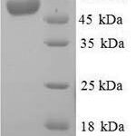 SDS-PAGE separation of QP8972 followed by commassie total protein stain results in a primary band consistent with reported data for Alkaline Phosphatase. These data demonstrate Greater than 90% as determined by SDS-PAGE.