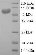 SDS-PAGE separation of QP8972 followed by commassie total protein stain results in a primary band consistent with reported data for Alkaline Phosphatase. These data demonstrate Greater than 90% as determined by SDS-PAGE.