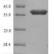 SDS-PAGE separation of QP8977 followed by commassie total protein stain results in a primary band consistent with reported data for ANTXR1. These data demonstrate Greater than 90% as determined by SDS-PAGE.