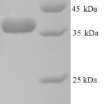 SDS-PAGE separation of QP8982 followed by commassie total protein stain results in a primary band consistent with reported data for ANXA5 / Annexin 5 / Annexin A5. These data demonstrate Greater than 89.50% as determined by SDS-PAGE.