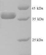 SDS-PAGE separation of QP8982 followed by commassie total protein stain results in a primary band consistent with reported data for ANXA5 / Annexin 5 / Annexin A5. These data demonstrate Greater than 89.50% as determined by SDS-PAGE.