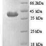 SDS-PAGE separation of QP8984 followed by commassie total protein stain results in a primary band consistent with reported data for Apoptotic protease-activating factor 1. These data demonstrate Greater than 90% as determined by SDS-PAGE.