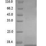 SDS-PAGE separation of QP8988 followed by commassie total protein stain results in a primary band consistent with reported data for Apolipoprotein B-100. These data demonstrate Greater than 90% as determined by SDS-PAGE.