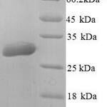 SDS-PAGE separation of QP8995 followed by commassie total protein stain results in a primary band consistent with reported data for Aquaporin-5. These data demonstrate Greater than 90% as determined by SDS-PAGE.