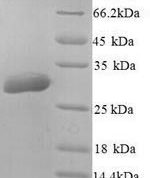 SDS-PAGE separation of QP8995 followed by commassie total protein stain results in a primary band consistent with reported data for Aquaporin-5. These data demonstrate Greater than 90% as determined by SDS-PAGE.