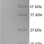 SDS-PAGE separation of QP9007 followed by commassie total protein stain results in a primary band consistent with reported data for BCHE / Butyrylcholinesterase. These data demonstrate Greater than 90% as determined by SDS-PAGE.