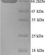 SDS-PAGE separation of QP9007 followed by commassie total protein stain results in a primary band consistent with reported data for BCHE / Butyrylcholinesterase. These data demonstrate Greater than 90% as determined by SDS-PAGE.