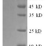 SDS-PAGE separation of QP9013 followed by commassie total protein stain results in a primary band consistent with reported data for Bruton Tyrosine Kinase / BTK Kinase. These data demonstrate Greater than 90% as determined by SDS-PAGE.