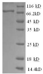SDS-PAGE separation of QP9013 followed by commassie total protein stain results in a primary band consistent with reported data for Bruton Tyrosine Kinase / BTK Kinase. These data demonstrate Greater than 90% as determined by SDS-PAGE.