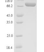 SDS-PAGE separation of QP9019 followed by commassie total protein stain results in a primary band consistent with reported data for C4b-binding protein alpha chain. These data demonstrate Greater than 90% as determined by SDS-PAGE.
