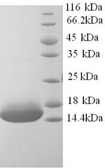 SDS-PAGE separation of QP9039 followed by commassie total protein stain results in a primary band consistent with reported data for Cyclin-J-like protein. These data demonstrate Greater than 90% as determined by SDS-PAGE.