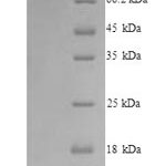 SDS-PAGE separation of QP9040 followed by commassie total protein stain results in a primary band consistent with reported data for C-C chemokine receptor type 5. These data demonstrate Greater than 90% as determined by SDS-PAGE.