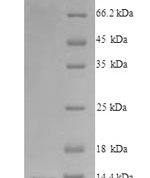 SDS-PAGE separation of QP9040 followed by commassie total protein stain results in a primary band consistent with reported data for C-C chemokine receptor type 5. These data demonstrate Greater than 90% as determined by SDS-PAGE.
