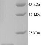 SDS-PAGE separation of QP9073 followed by commassie total protein stain results in a primary band consistent with reported data for CNKSR2. These data demonstrate Greater than 90% as determined by SDS-PAGE.