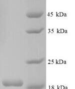SDS-PAGE separation of QP9073 followed by commassie total protein stain results in a primary band consistent with reported data for CNKSR2. These data demonstrate Greater than 90% as determined by SDS-PAGE.
