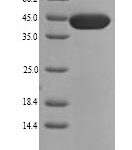 SDS-PAGE separation of QP9074 followed by commassie total protein stain results in a primary band consistent with reported data for Collagen alpha-1(XI) chain. These data demonstrate Greater than 90% as determined by SDS-PAGE.