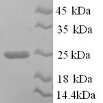 SDS-PAGE separation of QP9077 followed by commassie total protein stain results in a primary band consistent with reported data for Collagen alpha-1(I) chain. These data demonstrate Greater than 90% as determined by SDS-PAGE.