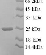 SDS-PAGE separation of QP9077 followed by commassie total protein stain results in a primary band consistent with reported data for Collagen alpha-1(I) chain. These data demonstrate Greater than 90% as determined by SDS-PAGE.
