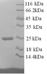 SDS-PAGE separation of QP9077 followed by commassie total protein stain results in a primary band consistent with reported data for Collagen alpha-1(I) chain. These data demonstrate Greater than 90% as determined by SDS-PAGE.