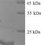 SDS-PAGE separation of QP9084 followed by commassie total protein stain results in a primary band consistent with reported data for Cancer / testis antigen 1. These data demonstrate Greater than 90% as determined by SDS-PAGE.