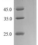 SDS-PAGE separation of QP9088 followed by commassie total protein stain results in a primary band consistent with reported data for CTP synthase 1. These data demonstrate Greater than 90% as determined by SDS-PAGE.