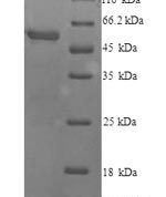 SDS-PAGE separation of QP9094 followed by commassie total protein stain results in a primary band consistent with reported data for Cytochrome P450 2E1. These data demonstrate Greater than 90% as determined by SDS-PAGE.