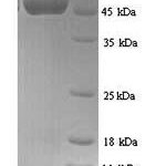 SDS-PAGE separation of QP9095 followed by commassie total protein stain results in a primary band consistent with reported data for Protein CYR61. These data demonstrate Greater than 90% as determined by SDS-PAGE.