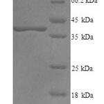 SDS-PAGE separation of QP9101 followed by commassie total protein stain results in a primary band consistent with reported data for Decorin / DCN / SLRR1B. These data demonstrate Greater than 90% as determined by SDS-PAGE.