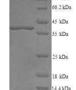 SDS-PAGE separation of QP9101 followed by commassie total protein stain results in a primary band consistent with reported data for Decorin / DCN / SLRR1B. These data demonstrate Greater than 90% as determined by SDS-PAGE.
