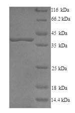 SDS-PAGE separation of QP9101 followed by commassie total protein stain results in a primary band consistent with reported data for Decorin / DCN / SLRR1B. These data demonstrate Greater than 90% as determined by SDS-PAGE.