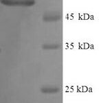 SDS-PAGE separation of QP9147 followed by commassie total protein stain results in a primary band consistent with reported data for Vitamin D-binding protein. These data demonstrate Greater than 90% as determined by SDS-PAGE.