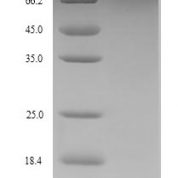 SDS-PAGE separation of QP9155 followed by commassie total protein stain results in a primary band consistent with reported data for GLP-1R / GLP1R. These data demonstrate Greater than 90% as determined by SDS-PAGE.